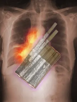 Concept Prints: Cigarettes and Lung Cancer