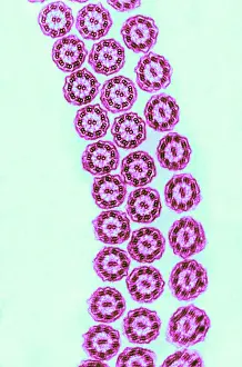 Cilia Prints: Cilia from Ciliates (TEM)