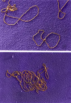 Gram Prints: Circular DNA and Polymerase Reaction, TEM