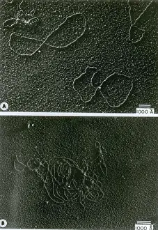 Pathogen Prints: Circular DNA and Polymerase Reaction, TEM