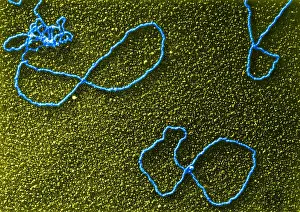 Pathogen Prints: Circular DNA, TEM
