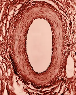 Non Pathological Prints: Circulatory System, Healthy Artery, TEM