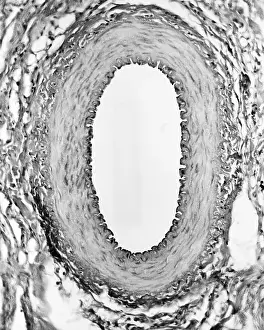 Non Pathological Prints: Circulatory System, Healthy Artery, TEM