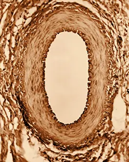Circulatory System, Healthy Artery, TEM