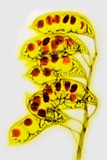 Seed Prints: Colorized X-ray of Seed Pods