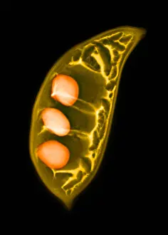 Seed Prints: Colorized X-ray of Seed Pods