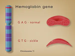 Mutation Prints: Comparison of hemoglobin in a sickle cell (sickle cell anemia disease) and a normal blood cell