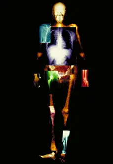 Medical Prints: Composite of body