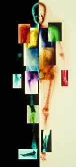 Scan Prints: Composite of body