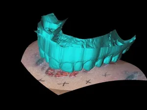 Court Prints: Computer Reconstruction of Bite Mark