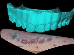 Technology Prints: Computer Reconstruction of Bite Mark