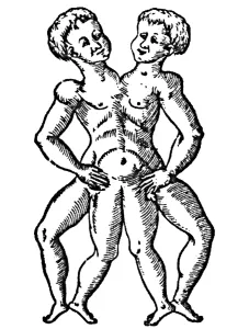 Twins Prints: Conjoined Twins, 16th Century