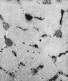 Fibers Prints: Connective Tissue, Skeletal Muscle, TEM