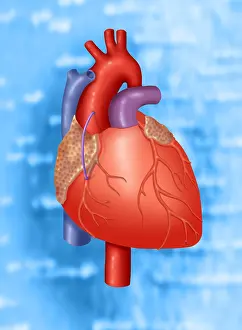 Circulation Prints: Coronary Vein Graft