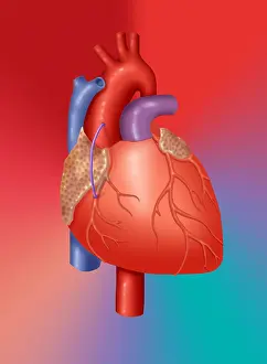 Surgery Prints: Coronary Vein Graft