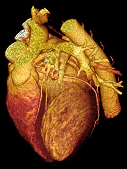 Computed Prints: CT Scan, Heart