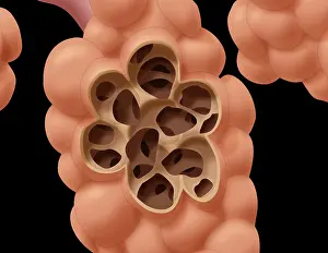 Damaged Alveoli