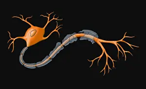 Demyelination Prints: Demyelination
