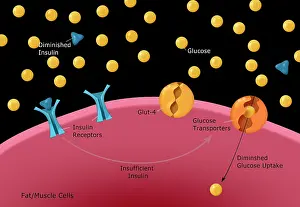 High Prints: Diagram of type I diabetes, insulin