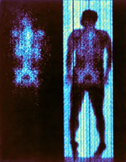 Medical Prints: Distribution of Red-Cell-Forming Tissue