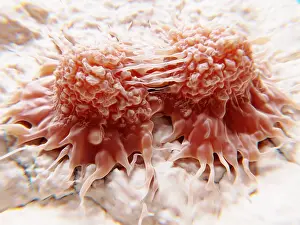 Pathological Prints: Dividing cancer cells