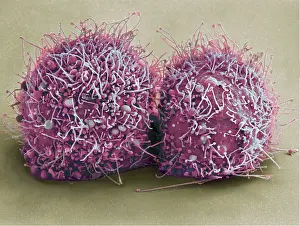 Research Prints: Dividing HeLa Cells, scanning electron micrograph