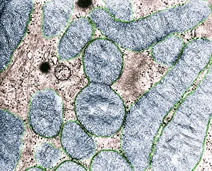 Prokaryote Prints: Dividing Mitochondrion, TEM