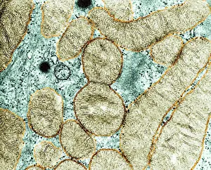 Prokaryote Prints: Dividing Mitochondrion, TEM