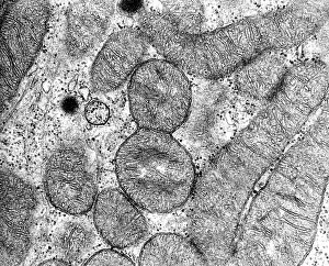 Prokaryote Prints: Dividing Mitochondrion, TEM