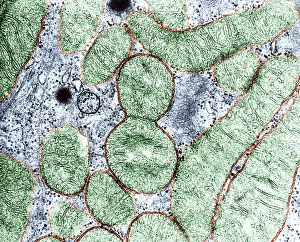 Prokaryote Prints: Dividing Mitochondrion, TEM