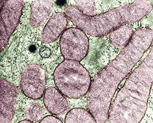 Prokaryote Prints: Dividing Mitochondrion, TEM