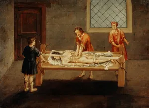 Middle Ages Prints: Doctors Setting Bones with a Hippocratic Bench, Ancient Greek Medical Device