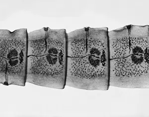 Tapeworm Prints: Dog Tapeworm under a microscope