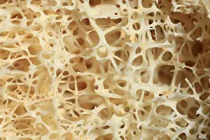 Normal Prints: Dried Human Bone, Normal