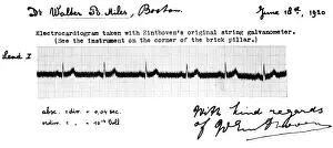 Technique Prints: Early Einthoven Electrocardiogram, 1903