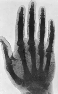 Early Prints: Early X-ray, 1897