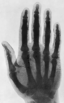 Early Prints: Early X-ray