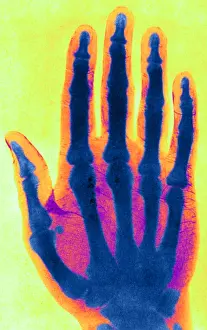 Early Prints: Early X-ray