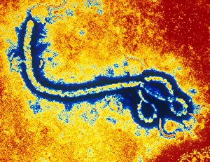 Pathogen Prints: Ebola Zaire Virus (TEM)