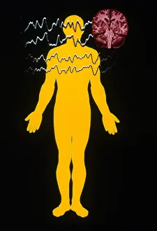Silhouette Prints: EEG of Tonic-clonic Seizure