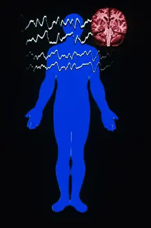 Silhouette Prints: EEG of Tonic-clonic Seizure