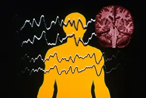 Silhouette Prints: EEG of Tonic-clonic Seizure