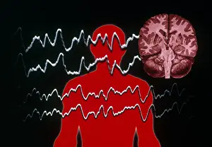 Silhouette Prints: EEG of Tonic-clonic Seizure