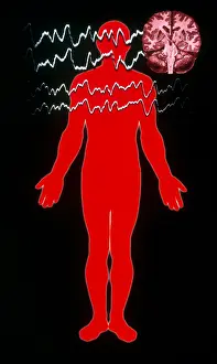 Silhouette Prints: EEG of Tonic-clonic Seizure