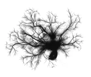 Electron Prints: Electric Spark