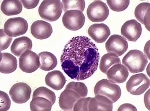 Micrograph Prints: Eosinophil and Erythrocytes Blood Cells, Under the Microscope