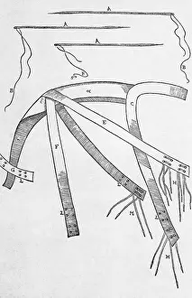 Operating Prints: Equipment for One of Tagliacozzi's Rhinoplasty Methods