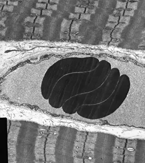 Erythrocytes, Capillary, Muscle Fibers, TEM