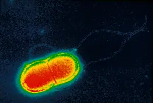 2000 Prints: Escherichia coli