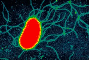 2000 Prints: Escherichia coli